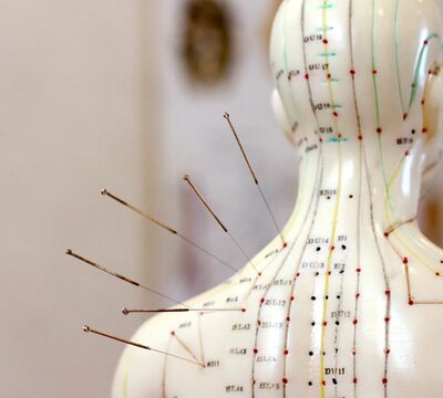 Курс «Иглотерапия для медиков» — Алматы | 5 дней по 3 час, 120 000 тг